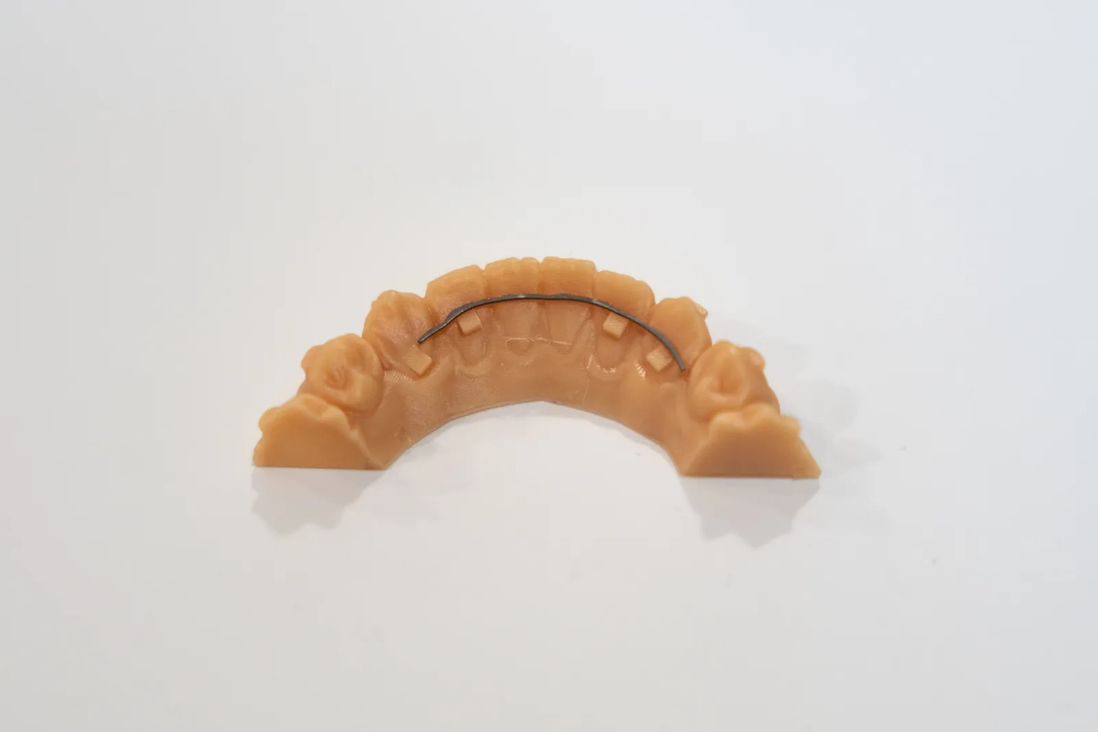 Fil de contention préparé sur un modèle dentaire imprimé en 3D